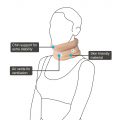 cervical collar with chin2